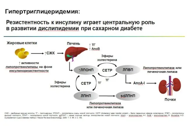 Гипертриглицеридемия: