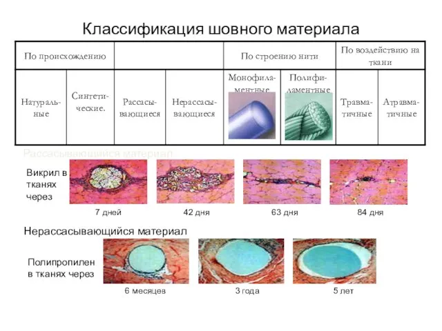 Классификация шовного материала Рассасывающийся материал: Викрил в тканях через Полипропилен в тканях через Нерассасывающийся материал