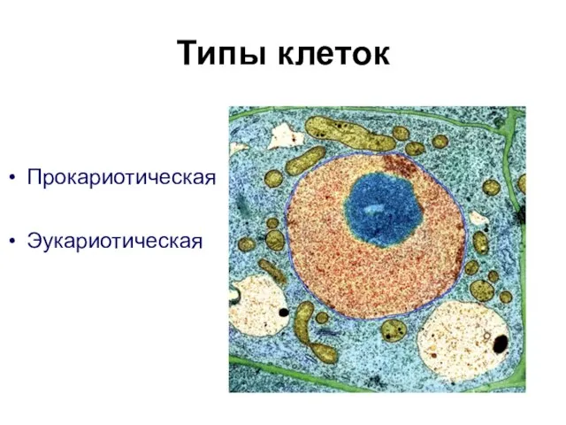 Типы клеток Прокариотическая Эукариотическая