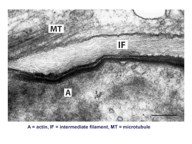 A = actin, IF = intermediate filament, MT = microtubule