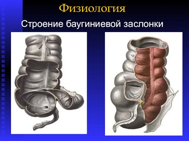 Физиология Строение баугиниевой заслонки