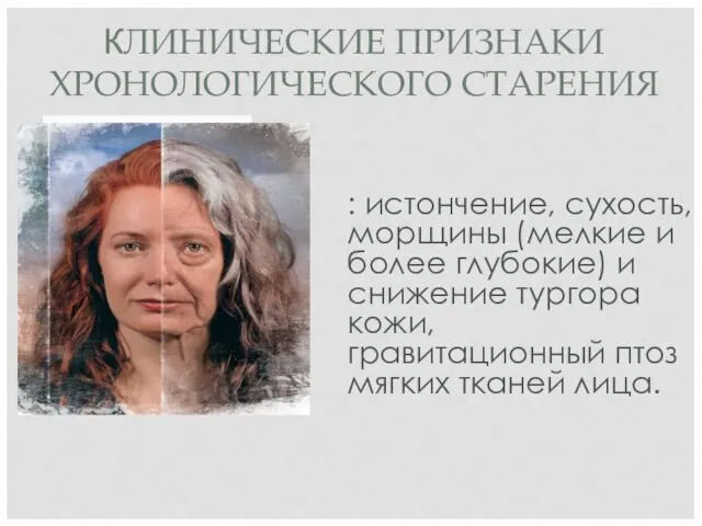 : истончение, сухость, морщины (мелкие и более глубокие) и снижение тургора