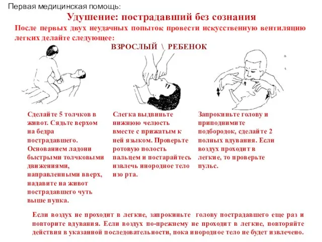 Удушение: пострадавший без сознания После первых двух неудачных попыток провести искусственную