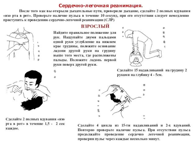 Сердечно-легочная реанимация. После того как вы открыли дыхательные пути, проверили дыхание,