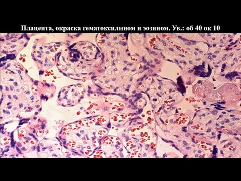 Плацента, окраска гематоксилином и эозином. Ув.: об 40 ок 10