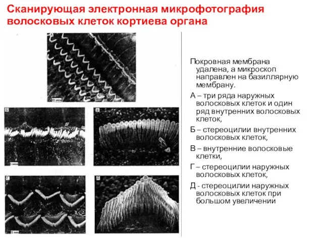 Сканирующая электронная микрофотография волосковых клеток кортиева органа Покровная мембрана удалена, а