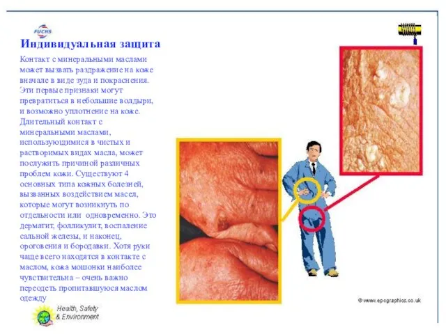 Индивидуальная защита Контакт с минеральными маслами может вызвать раздражение на коже