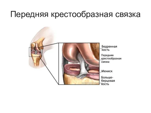 Передняя крестообразная связка