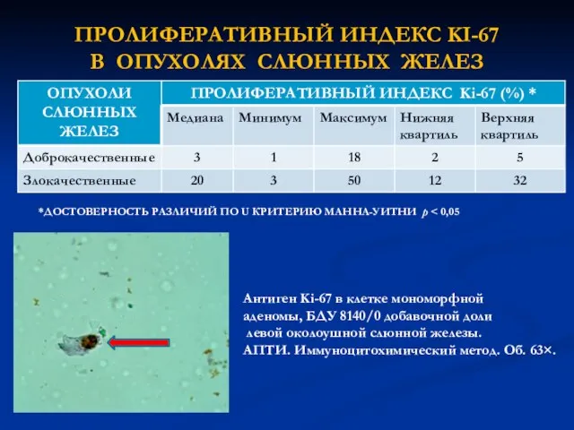 ПРОЛИФЕРАТИВНЫЙ ИНДЕКС KI-67 В ОПУХОЛЯХ СЛЮННЫХ ЖЕЛЕЗ *ДОСТОВЕРНОСТЬ РАЗЛИЧИЙ ПО U