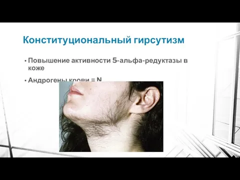 Конституциональный гирсутизм Повышение активности 5-альфа-редуктазы в коже Андрогены крови = N