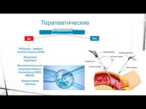 Терапевтические подходы Актуальность беременности Нет Да Индукция овуляции Оперативное лечение Вспомогательные