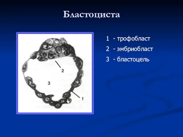 Бластоциста - трофобласт - эмбриобласт - бластоцель