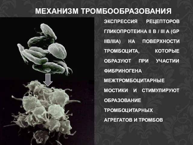 МЕХАНИЗМ ТРОМБООБРАЗОВАНИЯ ЭКСПРЕССИЯ РЕЦЕПТОРОВ ГЛИКОПРОТЕИНА II B / III A (GP