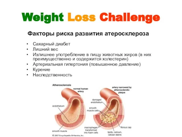 Weight Loss Challenge Сахарный диабет Лишний вес Излишнее употребление в пищу