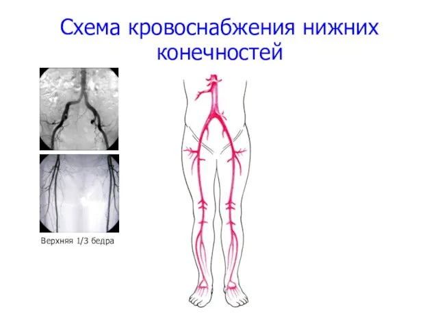 Схема кровоснабжения нижних конечностей Верхняя 1/3 бедра