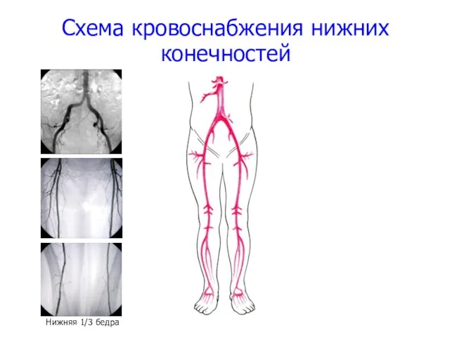 Схема кровоснабжения нижних конечностей Нижняя 1/3 бедра