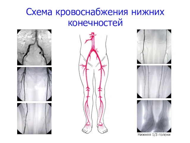 Схема кровоснабжения нижних конечностей Нижняя 1/3 голени