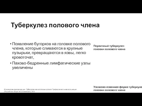 Туберкулез полового члена Появление бугорков на головке полового члена, которые сливаются