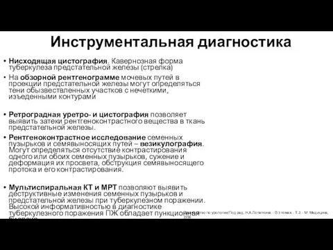 Инструментальная диагностика Нисходящая цистография. Кавернозная форма туберкулеза предстательной железы (стрелка) На