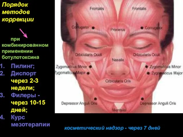 Пилинг; Диспорт через 2-3 недели; Филеры - через 10-15 дней; Курс