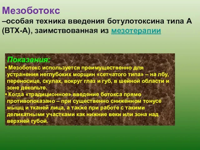 Мезоботокс –особая техника введения ботулотоксина типа А (ВТХ-А), заимствованная из мезотерапии