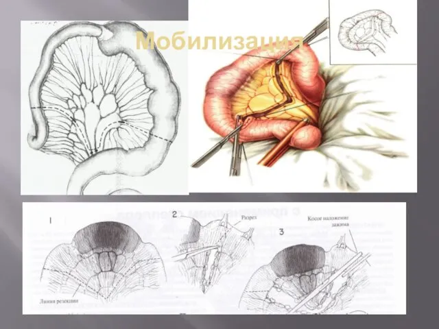 Мобилизация