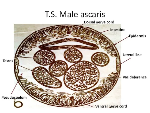 T.S. Male ascaris Testes Vas deference Epidermis Intestine Dorsal nerve cord