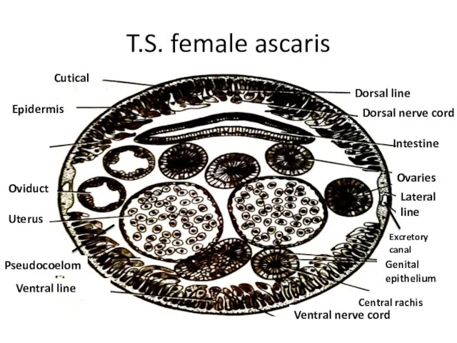T.S. female ascaris Dorsal nerve cord Dorsal line Intestine Cutical Epidermis