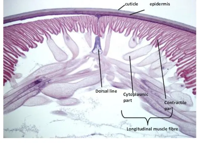 cuticle epidermis Dorsal line Cytoplasmic part Contractile part Longitudinal muscle fibre