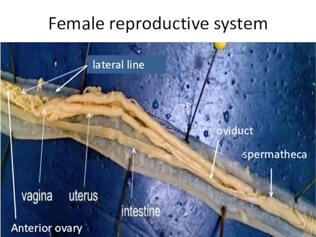 Female reproductive system Anterior ovary spermatheca oviduct lateral line
