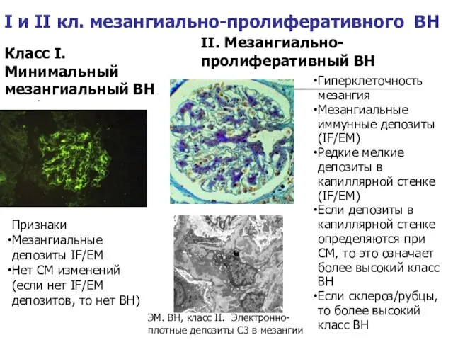 I и II кл. мезангиально-пролиферативного ВН Класс I. Минимальный мезангиальный ВН