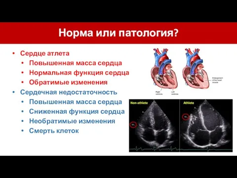 Норма или патология? Сердце атлета Повышенная масса сердца Нормальная функция сердца