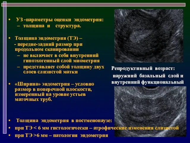 УЗ -параметры оценки эндометрия: толщина и структура. Толщина эндометрия (ТЭ) –