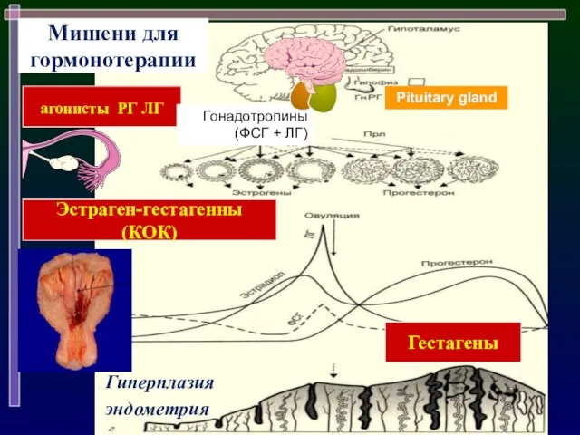 Эстраген-гестагенны (КОК) агонисты РГ ЛГ Мишени для гормонотерапии Гестагены Гиперплазия эндометрия