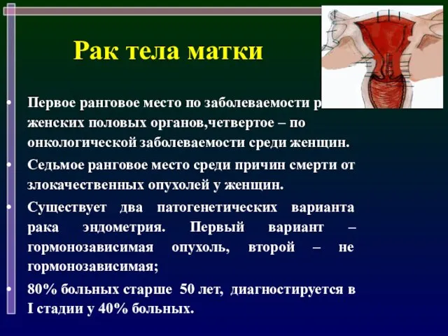 Рак тела матки Первое ранговое место по заболеваемости раком женских половых