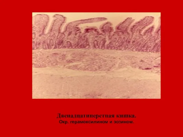 Двенадцатиперстная кишка. Окр. герамоксилином и эозином.