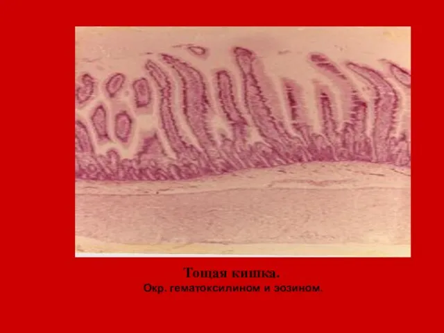 Тощая кишка. Окр. гематоксилином и эозином.