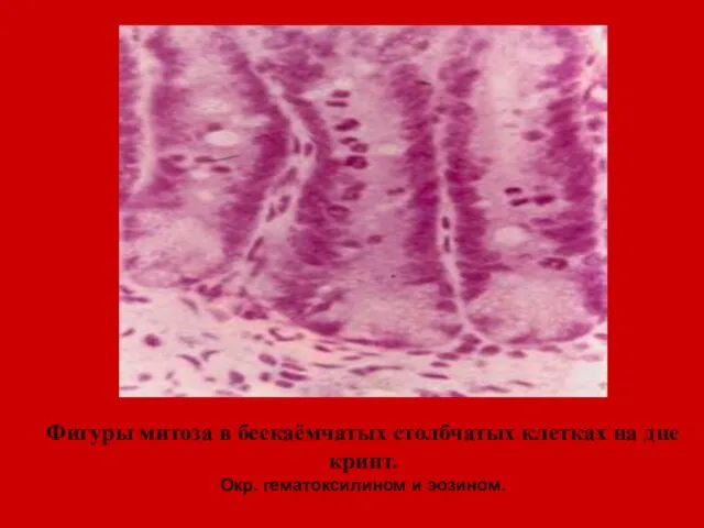 Фигуры митоза в бескаёмчатых столбчатых клетках на дне крипт. Окр. гематоксилином и эозином.