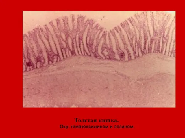 Толстая кишка. Окр. гематоксилином и эозином.