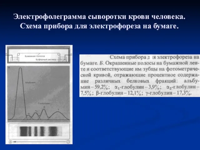 Электрофолеграмма сыворотки крови человека. Схема прибора для электрофореза на бумаге.