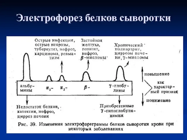 Электрофорез белков сыворотки