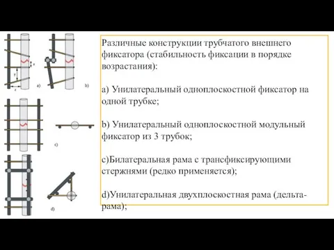 Различные конструкции трубчатого внешнего фиксатора (стабильность фиксации в порядке возрастания): а)