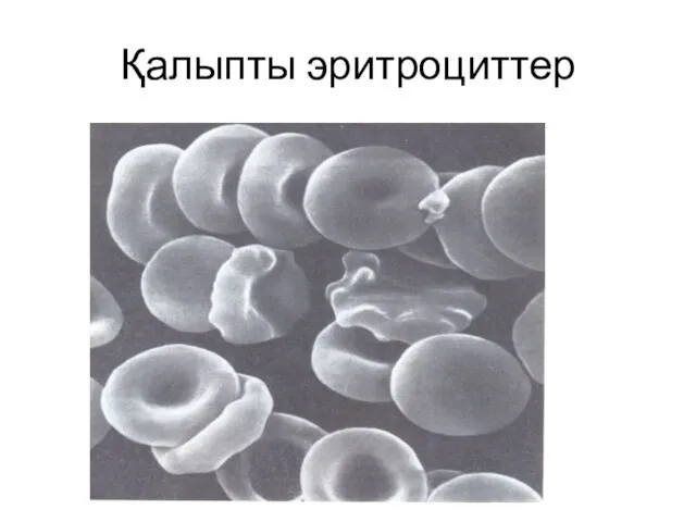 Қалыпты эритроциттер