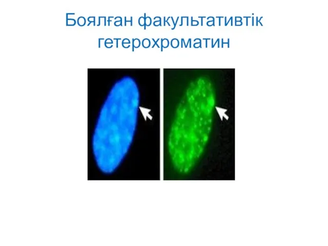 Боялған факультативтік гетерохроматин