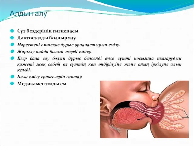 Алдын алу Сүт бездерінің гигиенасы Лактостазды болдырмау. Нәрестені емшекке дұрыс орналастырып