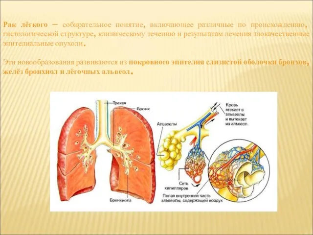 Рак лёгкого — собирательное понятие, включающее различные по происхождению, гистологической структуре,