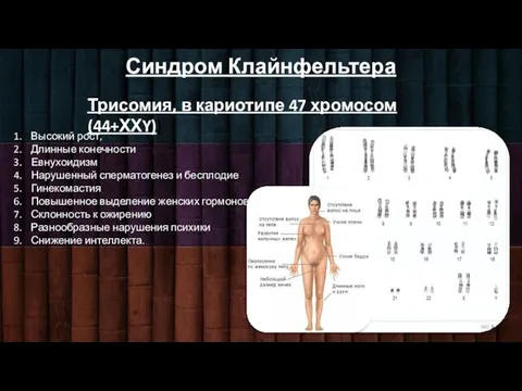 Синдром Клайнфельтера Трисомия, в кариотипе 47 хромосом (44+ХХY)) Высокий рост, Длинные