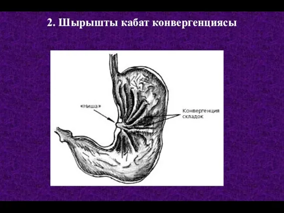 2. Шырышты кабат конвергенциясы