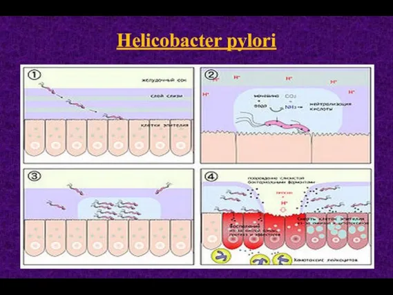 Helicobacter pylori