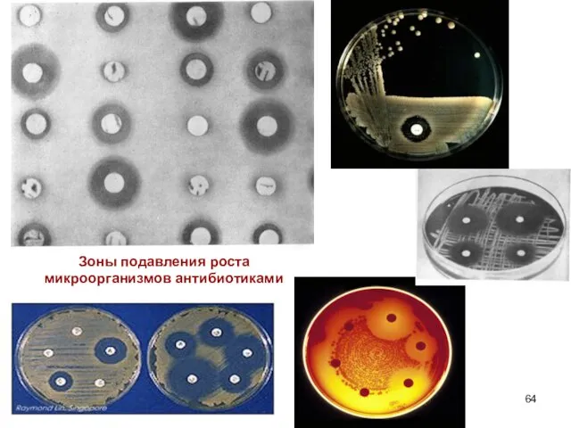 Зоны подавления роста микроорганизмов антибиотиками